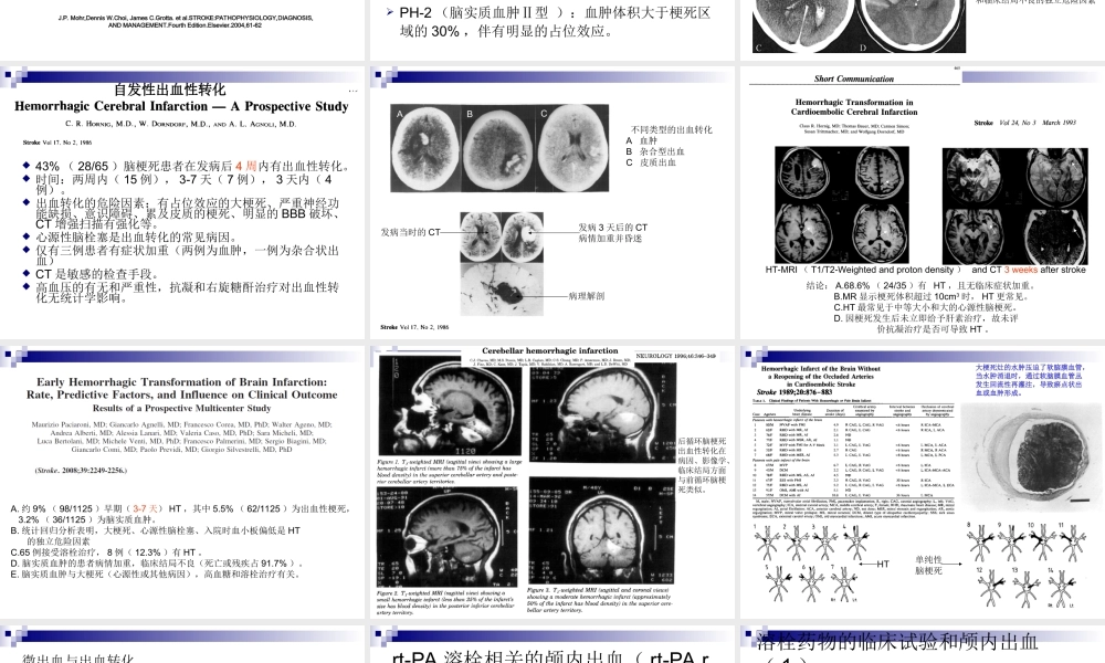 急性缺血性脑卒中的出血转换.ppt