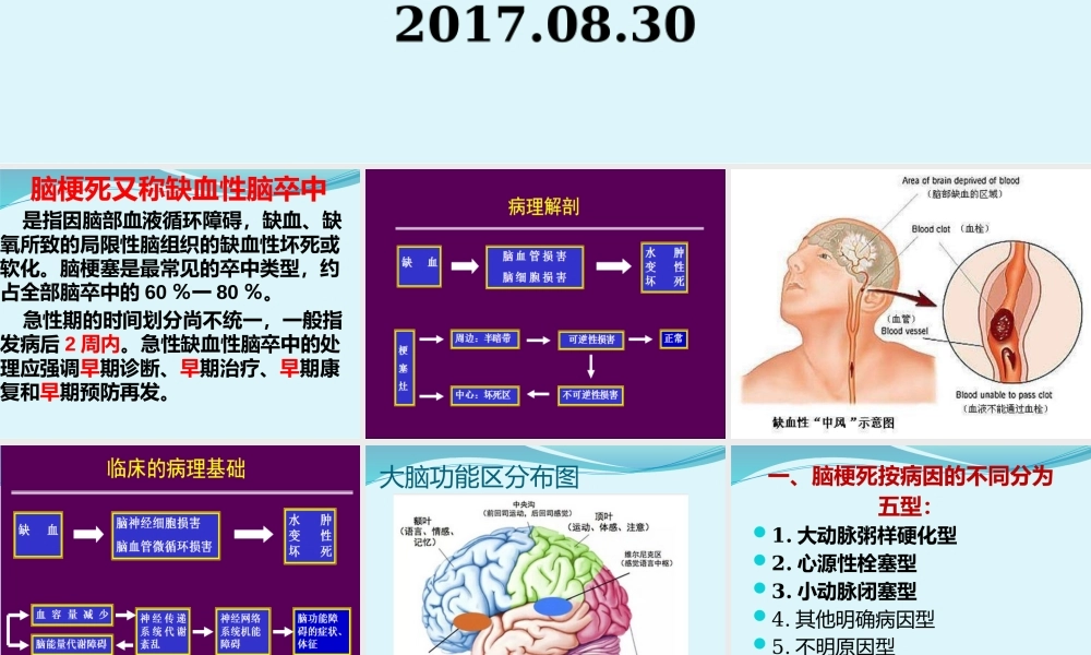 急性缺血性脑卒中诊疗规范.pptx