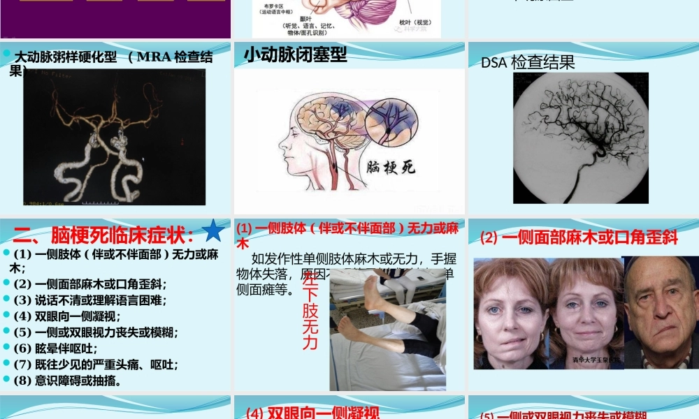 急性缺血性脑卒中诊疗规范.pptx