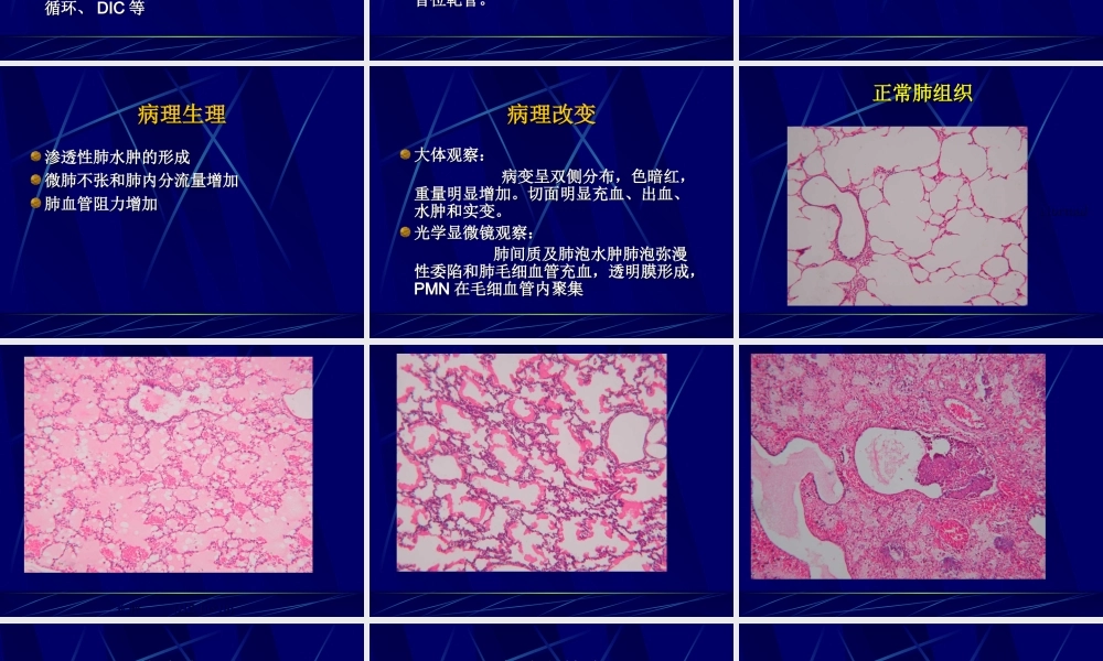 急性肺损伤和急性呼吸窘迫综合.ppt