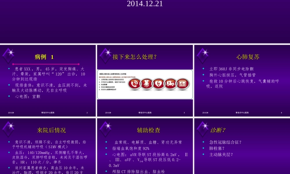 急性胸痛4例.ppt