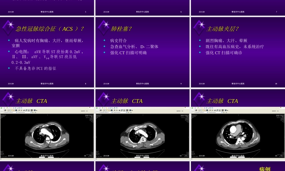 急性胸痛4例.ppt