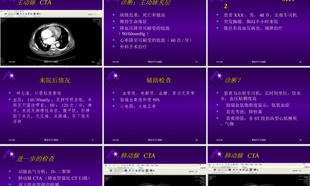 急性胸痛4例.ppt