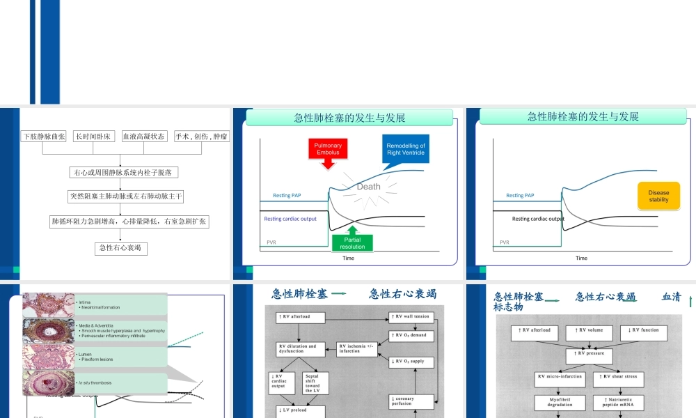 急性肺栓塞与急性右心衰竭.ppt