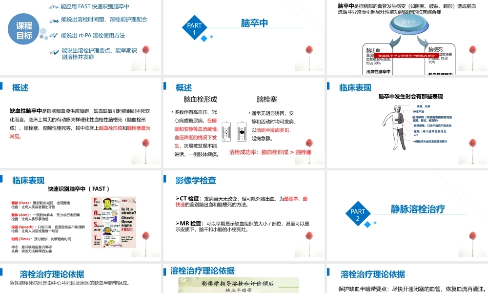 急性脑梗静脉溶栓.pptx