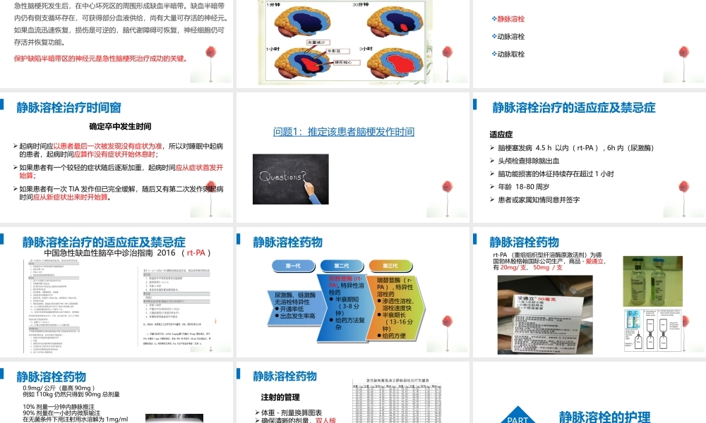 急性脑梗静脉溶栓.pptx