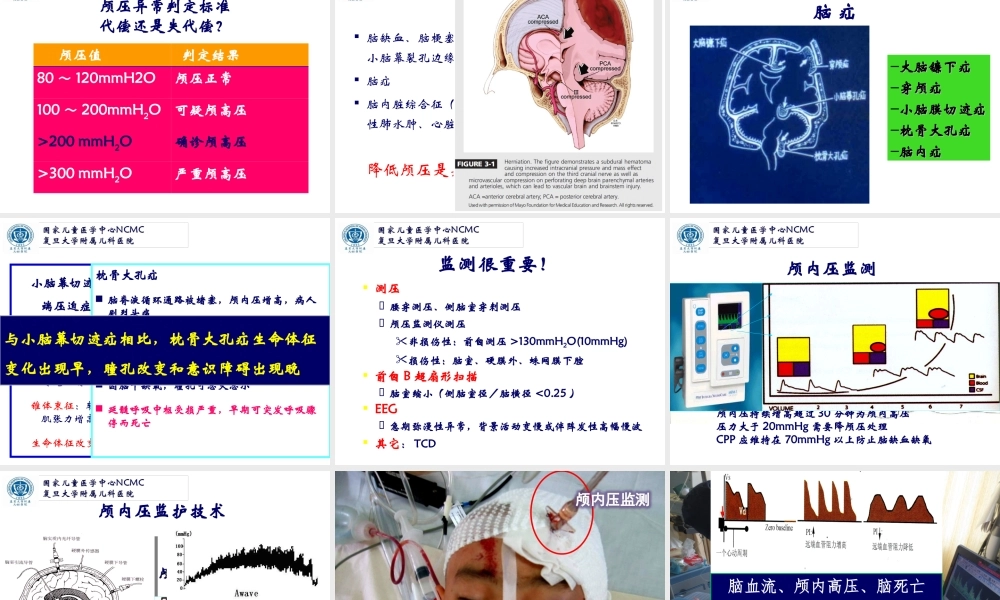 急性脑水肿与颅内高压--复旦儿科-陆国平-2018.ppt