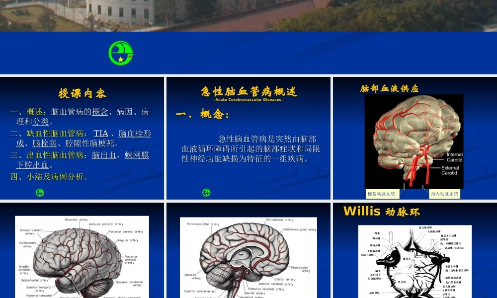 急性脑血管病浅论.ppt