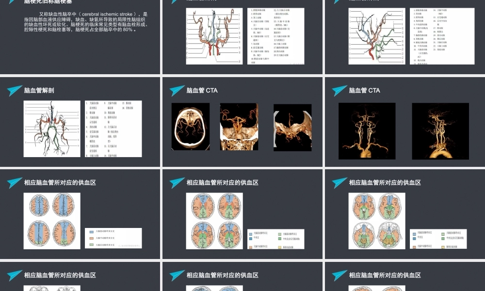 急性脑梗塞的责任血管判定.pptx