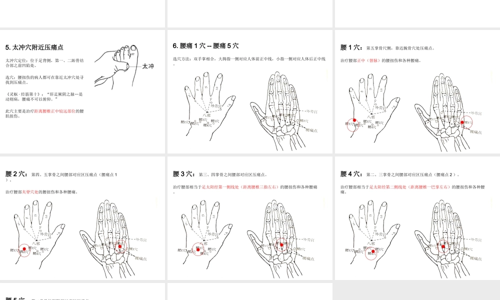 急性腰扭伤一针疗法.ppt
