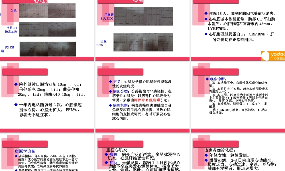 急性重症心肌炎病例讨论.ppt
