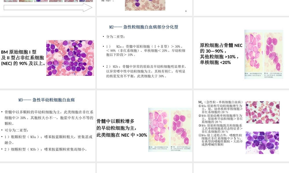 急性非淋巴细胞白血病.ppt