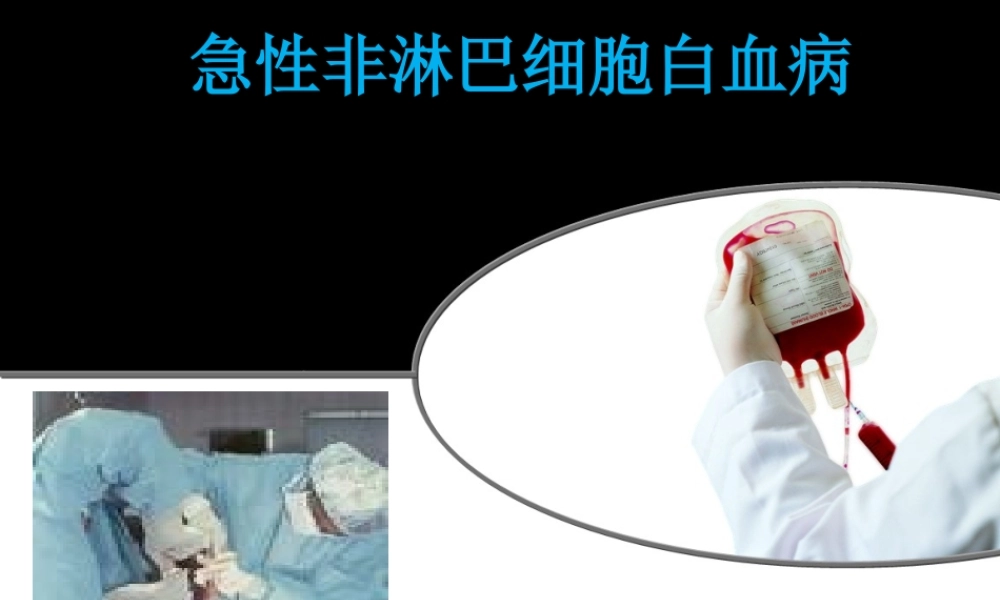 急性非淋巴细胞白血病PPT.ppt