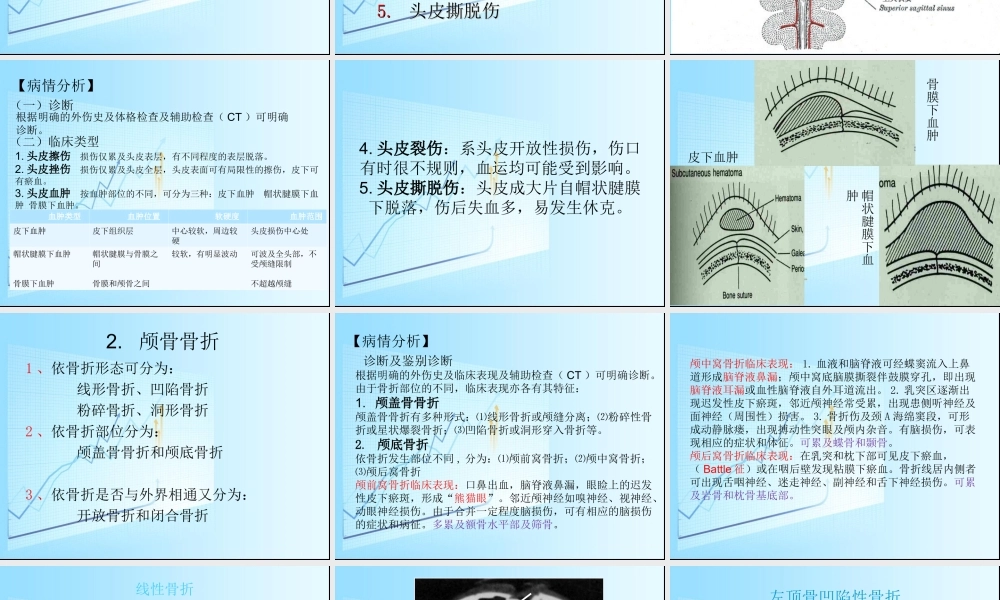 急性颅脑损伤概要.ppt