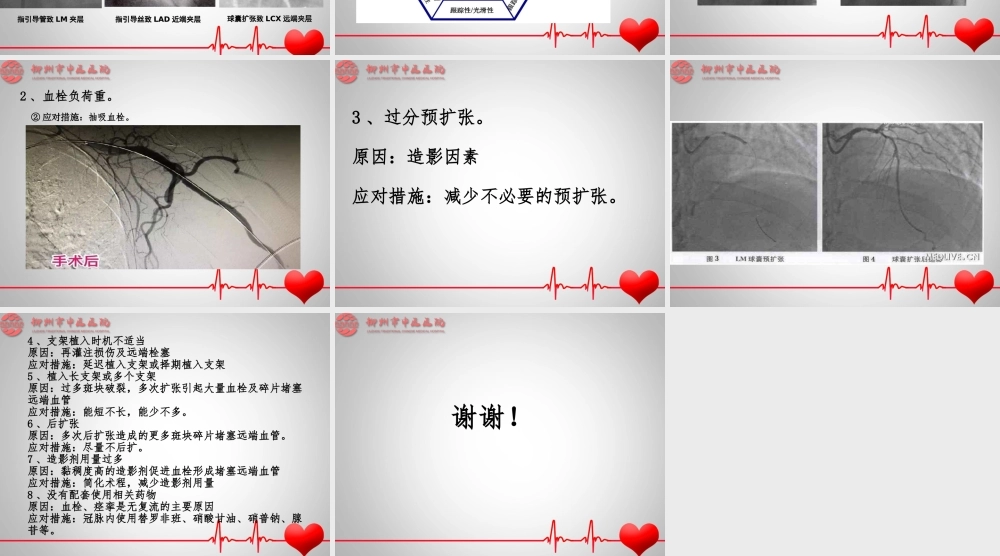 急诊PCI无复流--慢血流的预测因素及处理策略.ppt