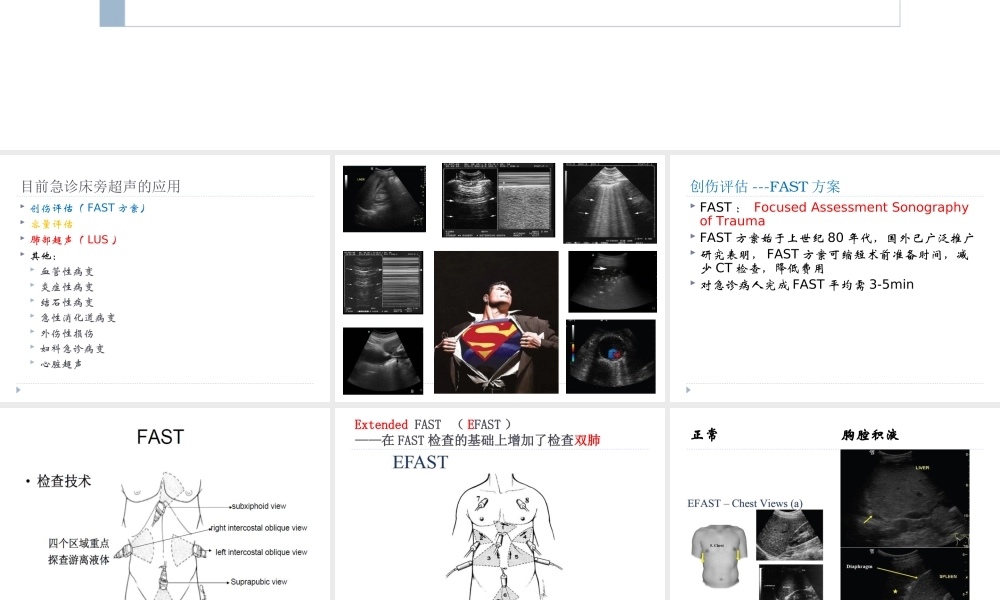 急诊床旁超声的应用详解.ppt