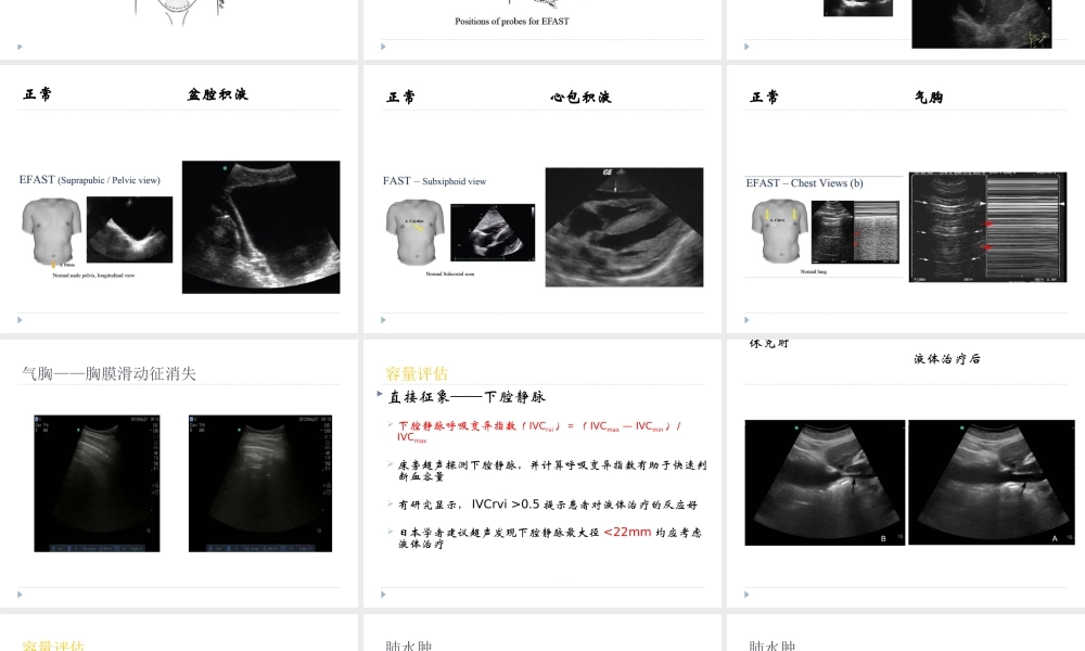 急诊床旁超声的应用详解.ppt