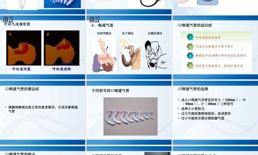 急诊科常见的抢救配合.ppt