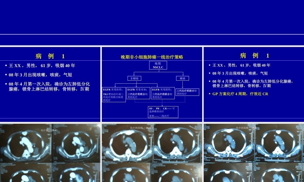 恩度病例分享郭沁香.ppt