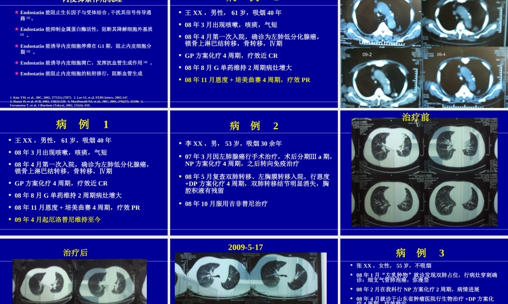 恩度病例分享郭沁香.ppt