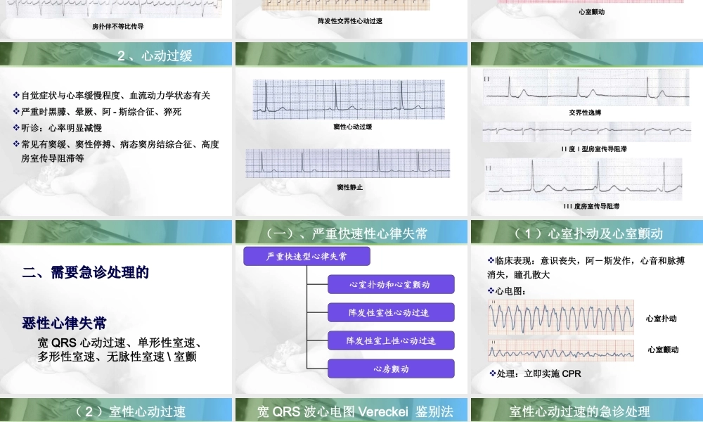 恶性心律失常的急诊处理.ppt
