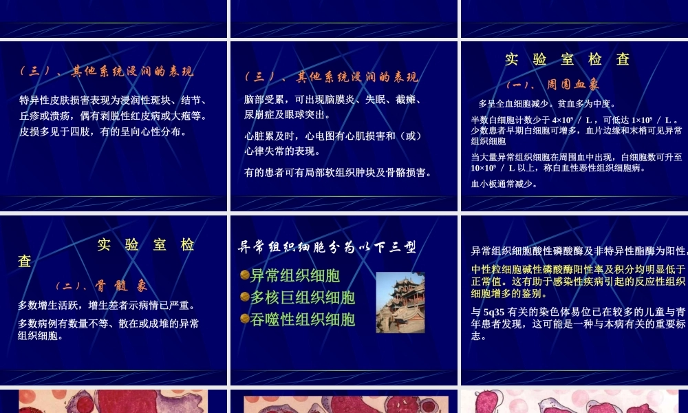 恶性组织细胞病.ppt