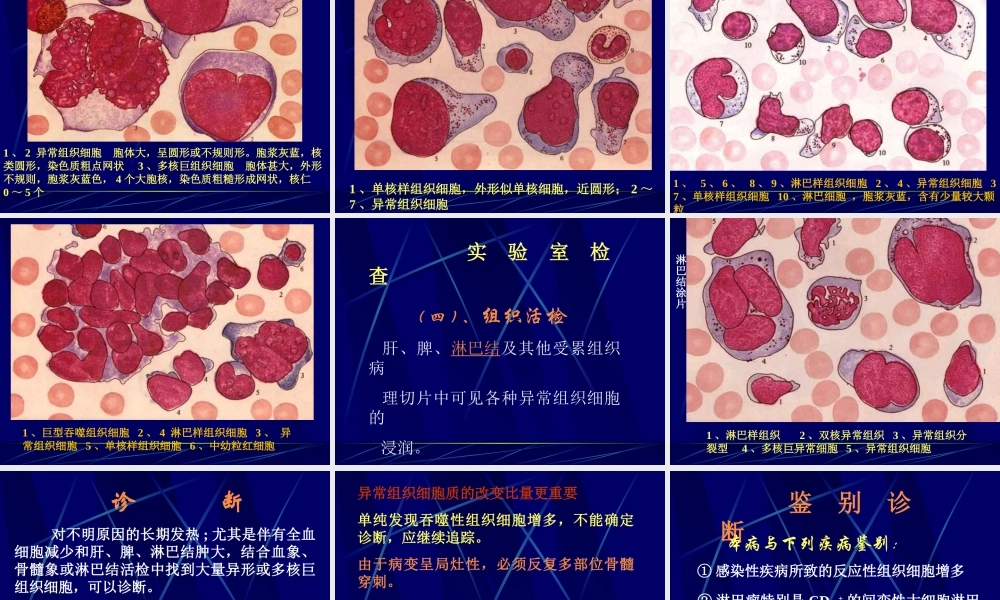 恶性组织细胞病.ppt
