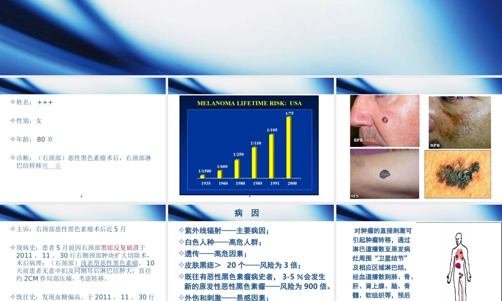 恶性黑色素瘤1.ppt