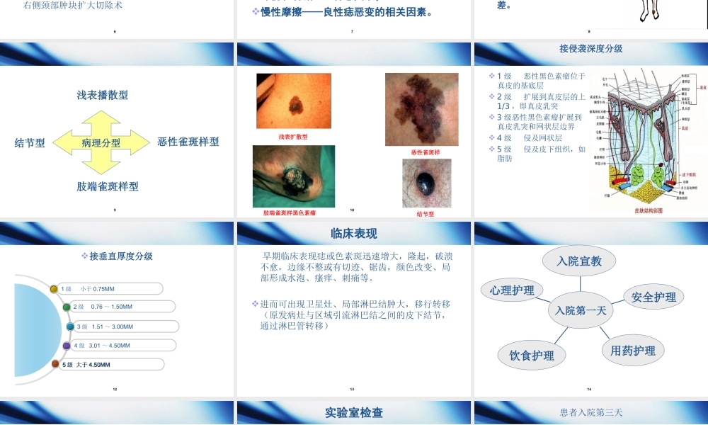 恶性黑色素瘤1.ppt