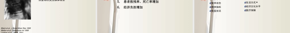 悄悄来临的骨质疏松症.ppt
