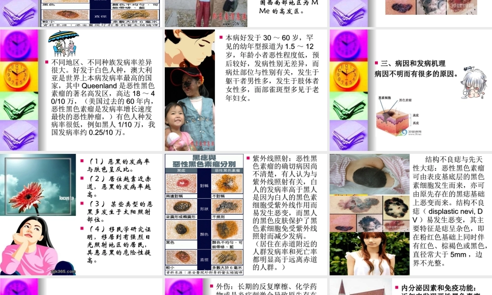 恶性黑色素瘤2010.ppt