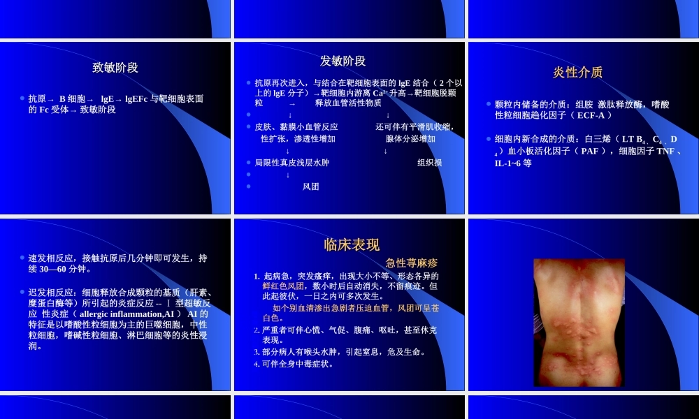 患者因全身风团3天-瘙痒就诊-发病前1周因.ppt