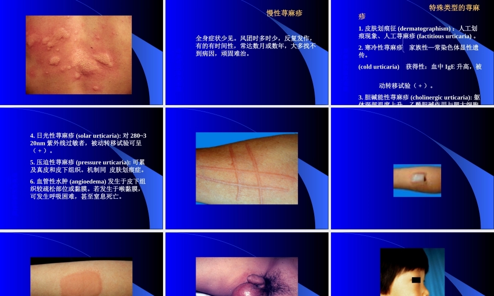 患者因全身风团3天-瘙痒就诊-发病前1周因.ppt