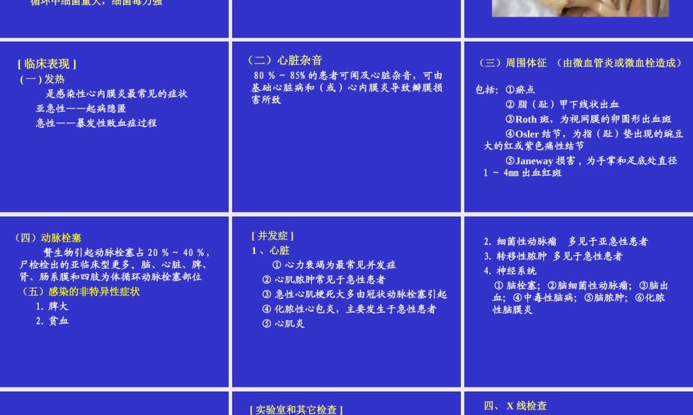 感染性心内膜炎-幻灯.ppt