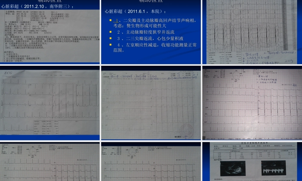 感染性心内膜炎一例.ppt