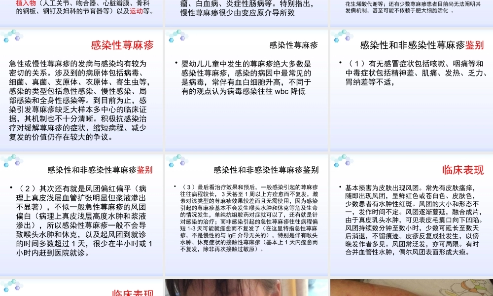 感染性荨麻疹疹.pptx