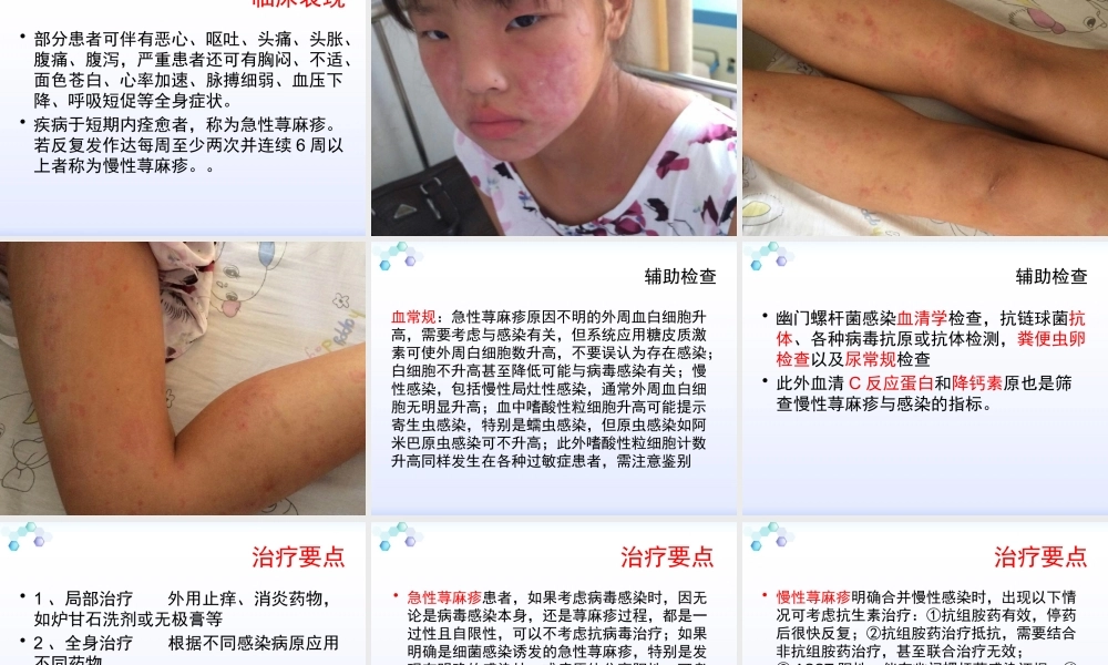 感染性荨麻疹疹.pptx