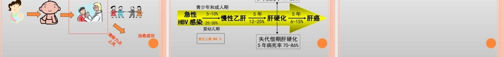 慢乙肝的诊治.ppt