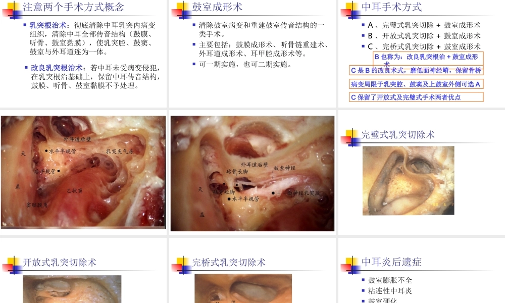 慢性中耳病变诊治策略.ppt