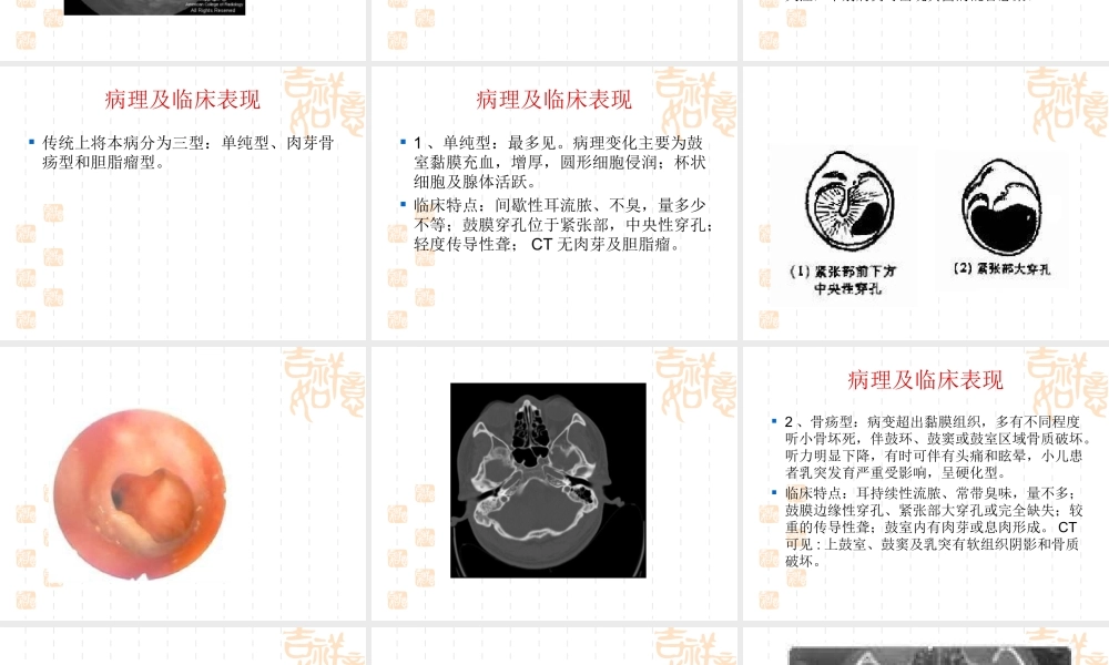 慢性化脓性中耳炎耳源性颅内外并发症.ppt