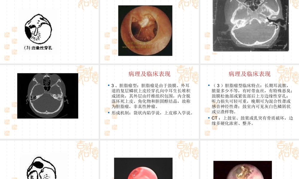 慢性化脓性中耳炎耳源性颅内外并发症.ppt