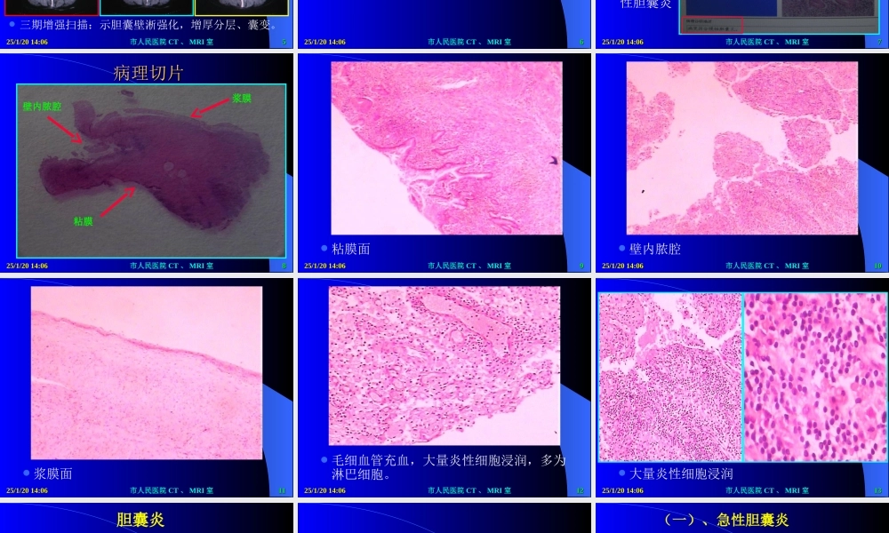 慢性化脓性胆囊炎.ppt