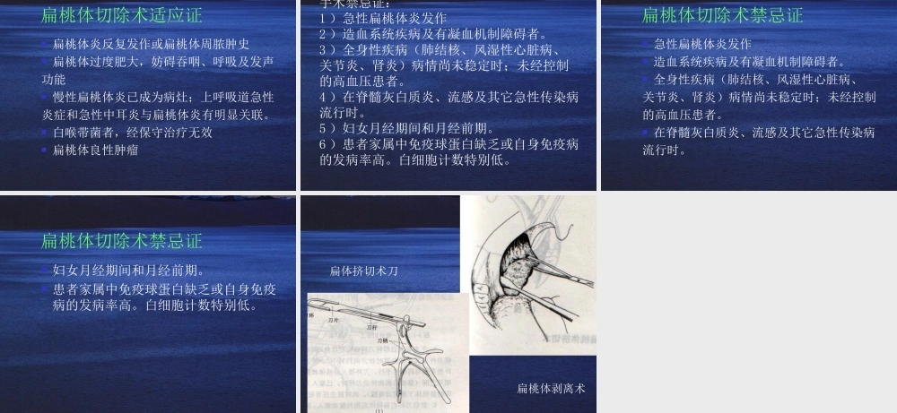 慢性扁桃体炎.ppt