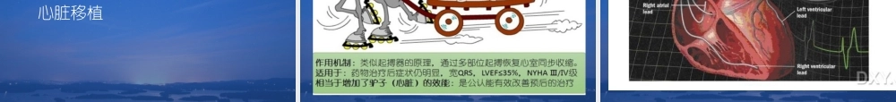 慢性心衰教学查房.ppt