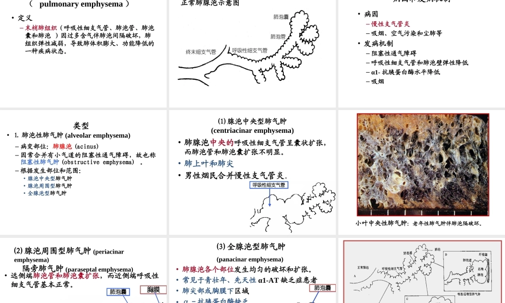 慢性支气管炎、肺气肿、肺硅沉着病.ppt