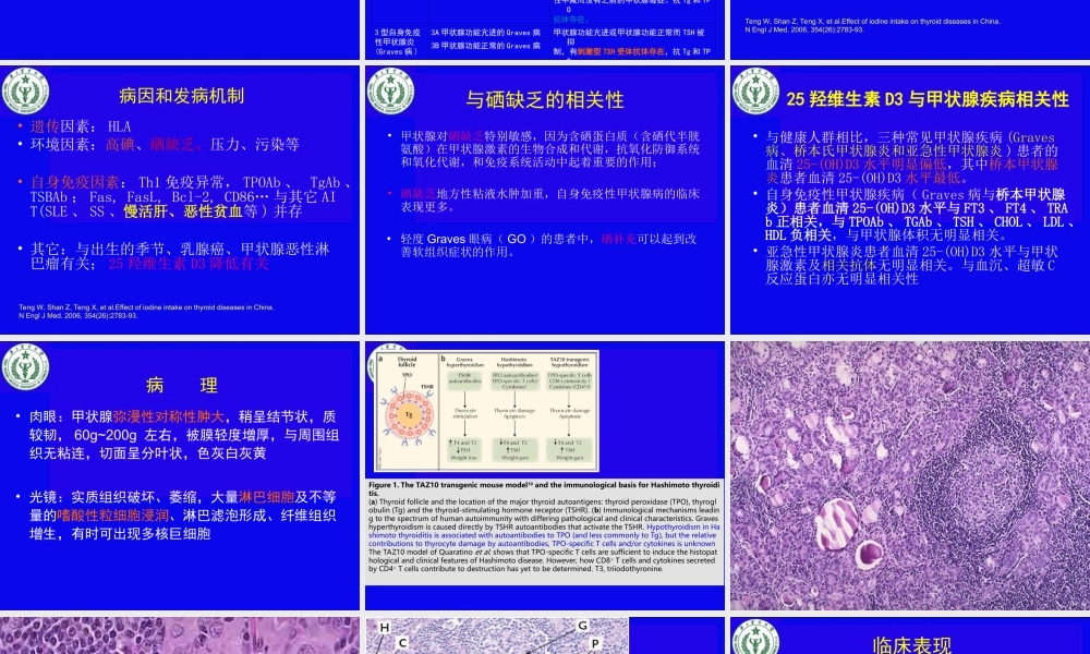 慢性淋巴细胞性甲状腺炎幻灯片.ppt