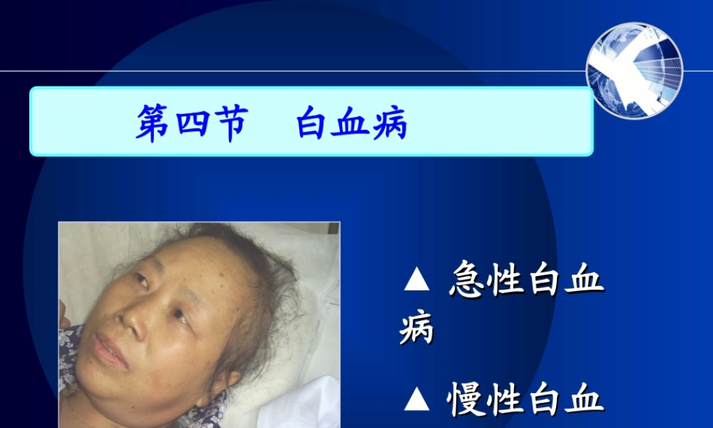 慢性淋巴细胞白血病.ppt