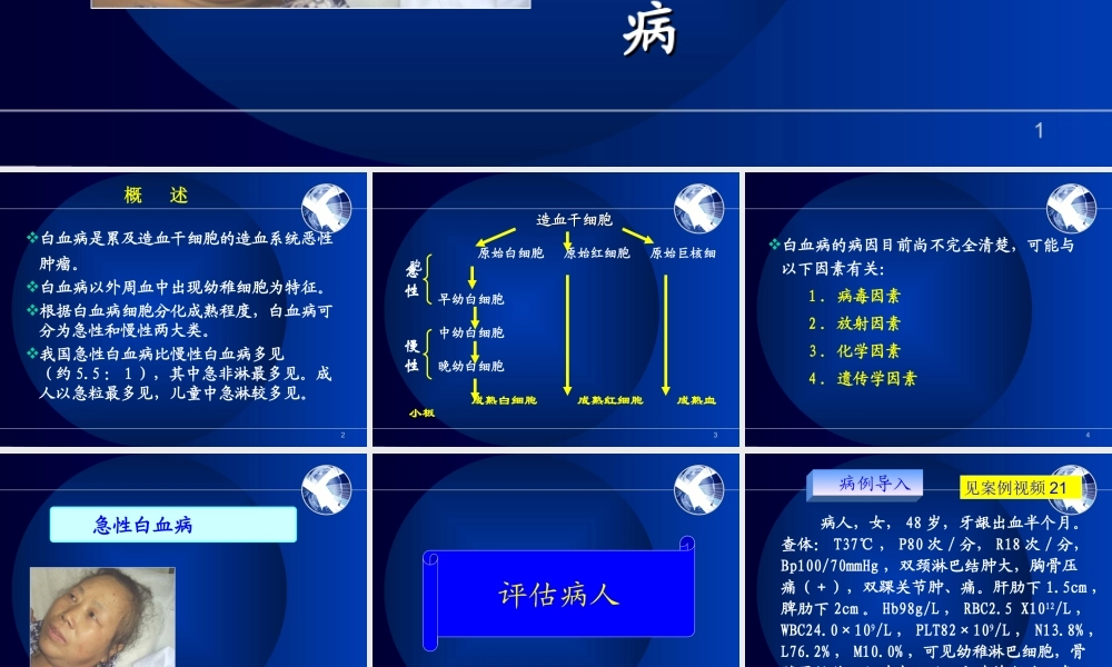 慢性淋巴细胞白血病.ppt