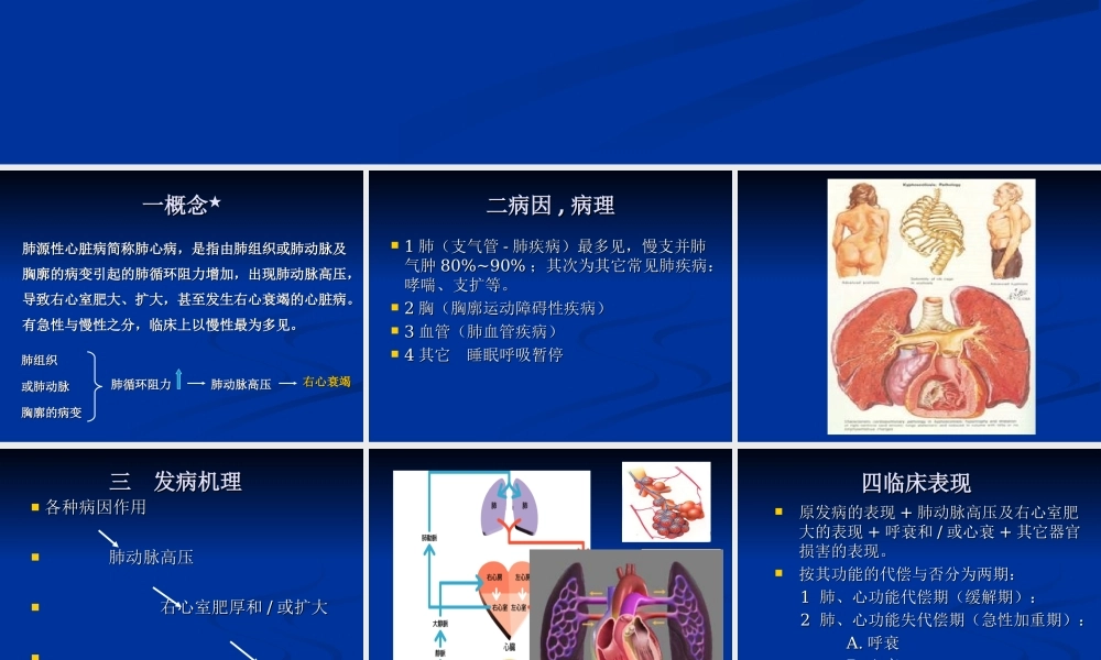 慢性肺源性心脏病sss.ppt