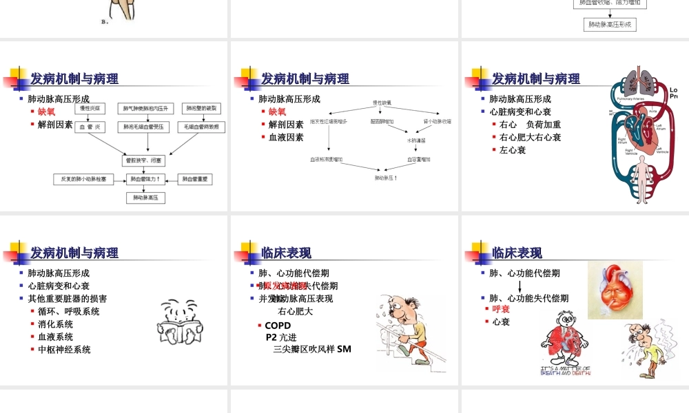 慢性肺源性心脏病讲解.ppt